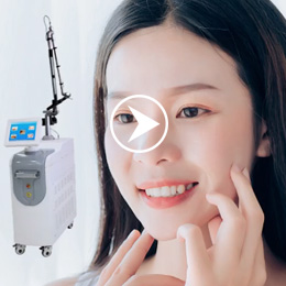 การรักษารอยดำสิวด้วย Q-Switch Nd Yag laser